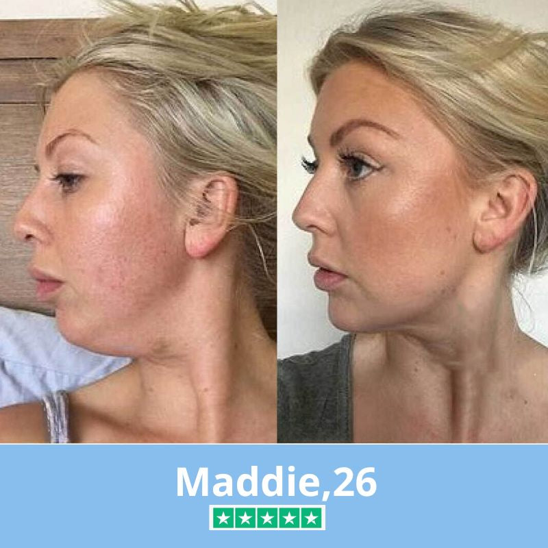 Retigena-LiftingMask