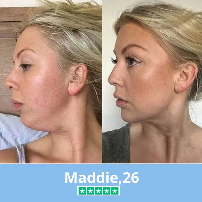 Retigena-LiftingMask