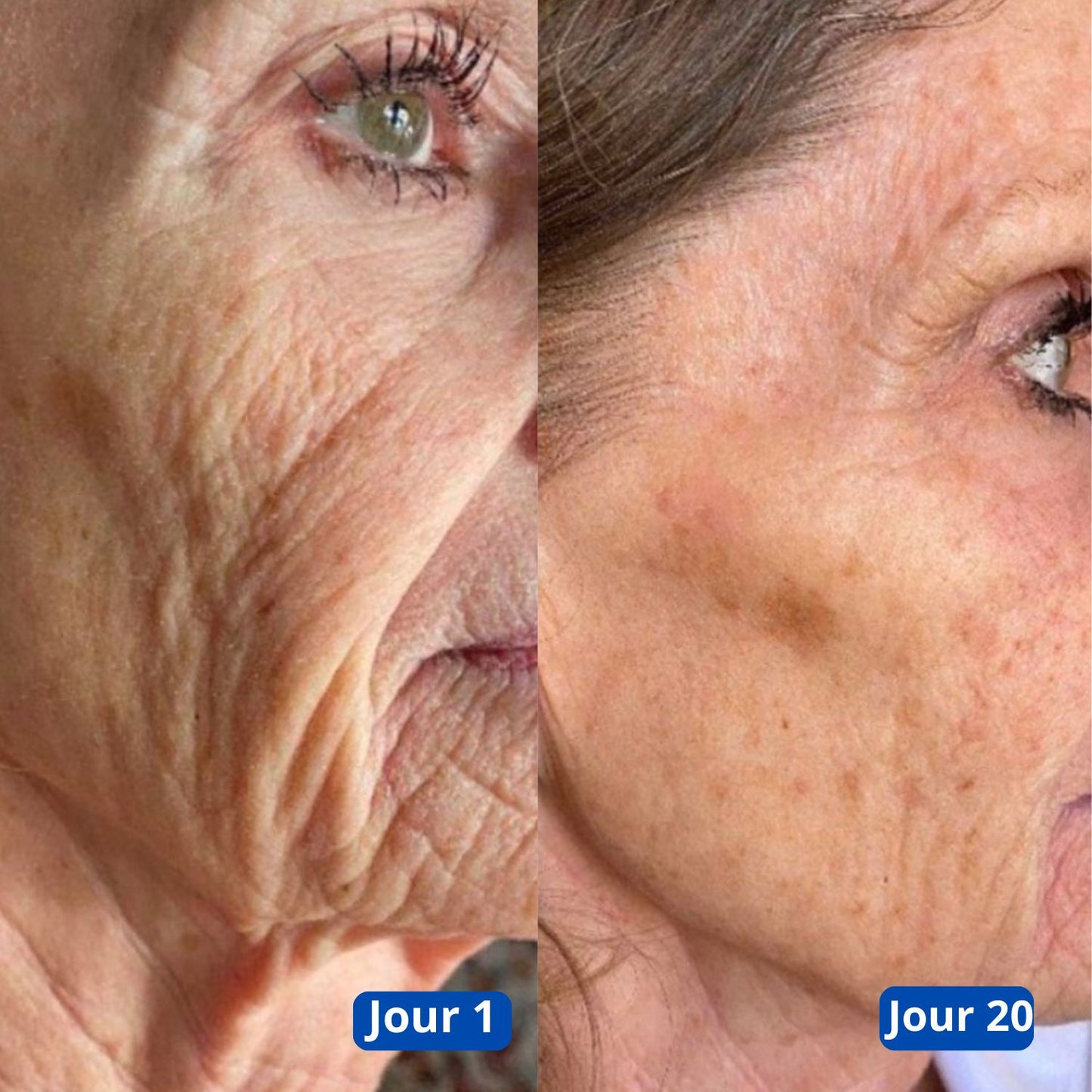 Retigena-LiftingMask