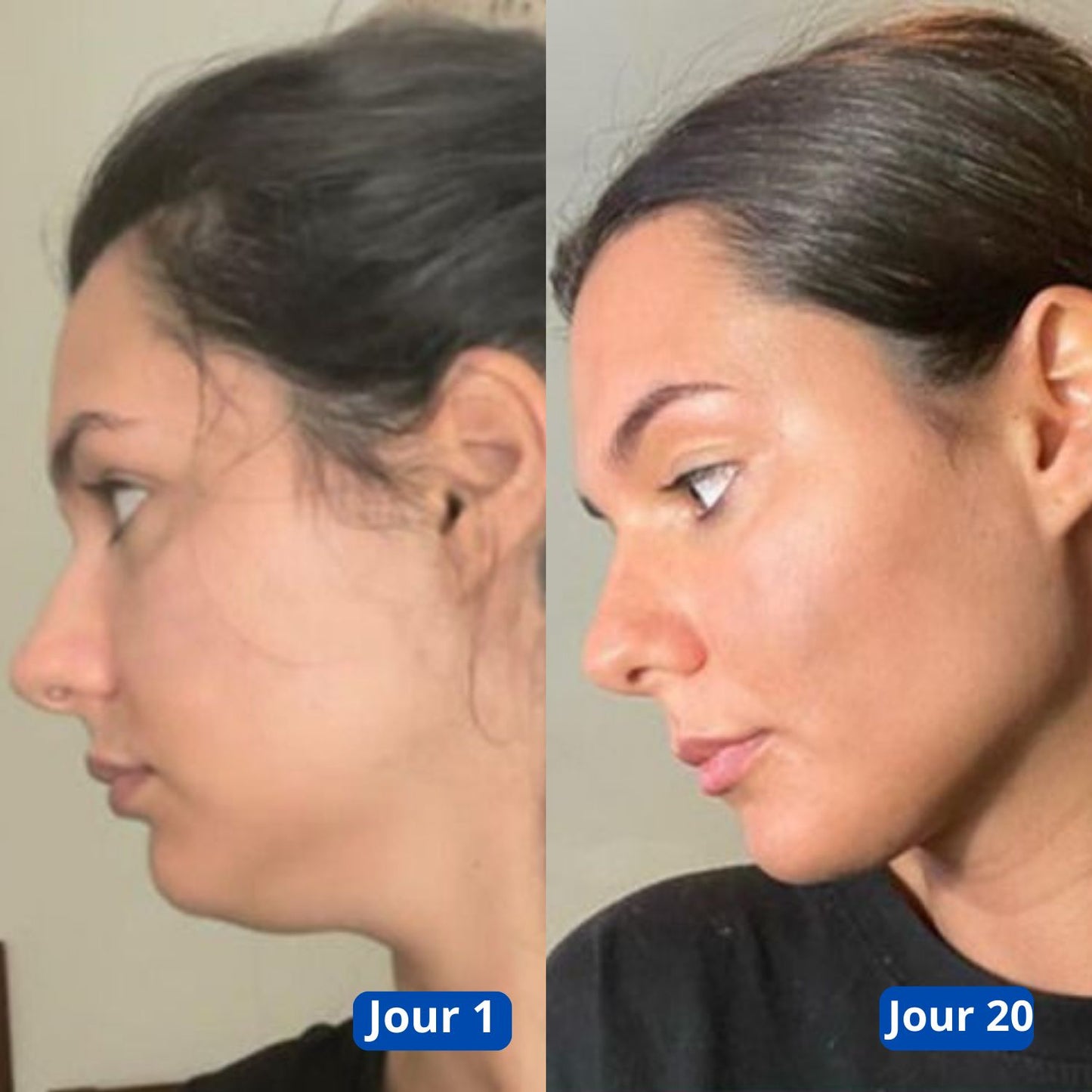 Retigena-LiftingMask