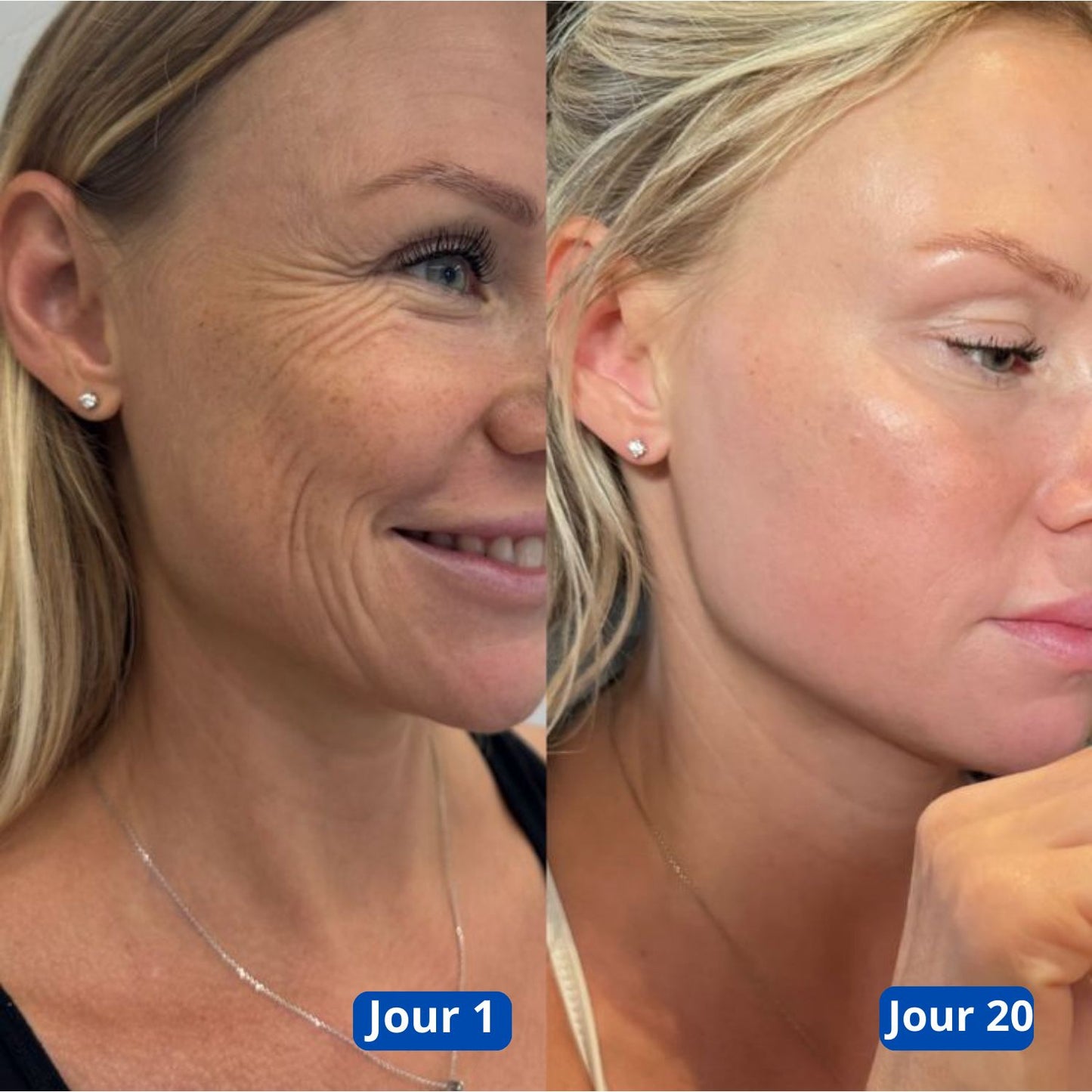 Retigena-LiftingMask